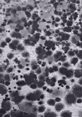 Черная плесень — страшилка или реальная угроза?